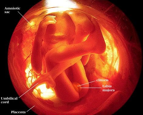 baby girl at 5 months